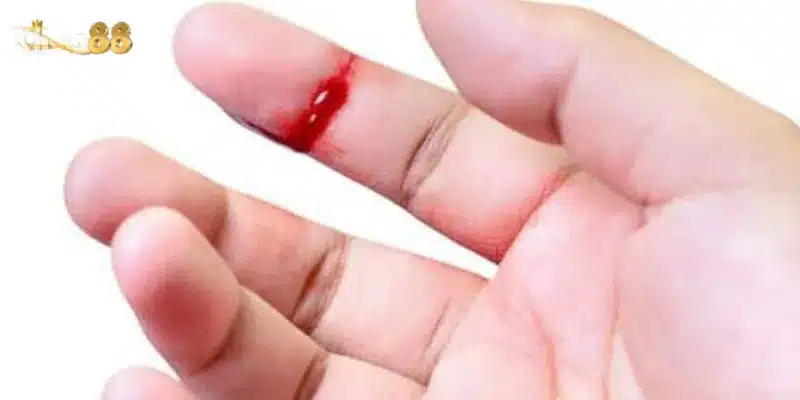 Nằm mơ thấy máu đỏ – Dự đoán chuẩn xác con lô đề hôm nay 7 Nằm mơ thấy máu đỏ đánh con số nào giúp bạn trúng lớn?